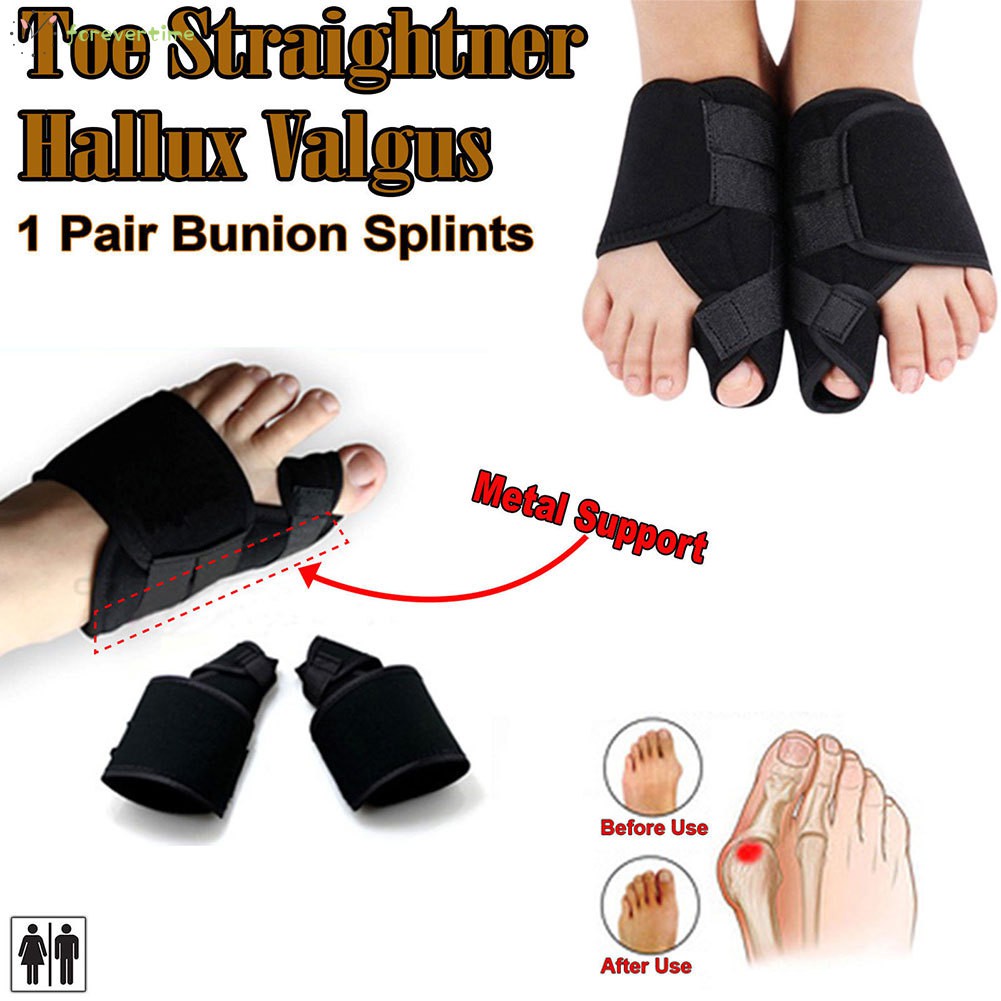☞Chính xác☜ 1 Pair Toe Bunion Corrector Foot Pain Relief Hallux Valgus Splint Brace Toes Care Straightener Pedicure Orthotics