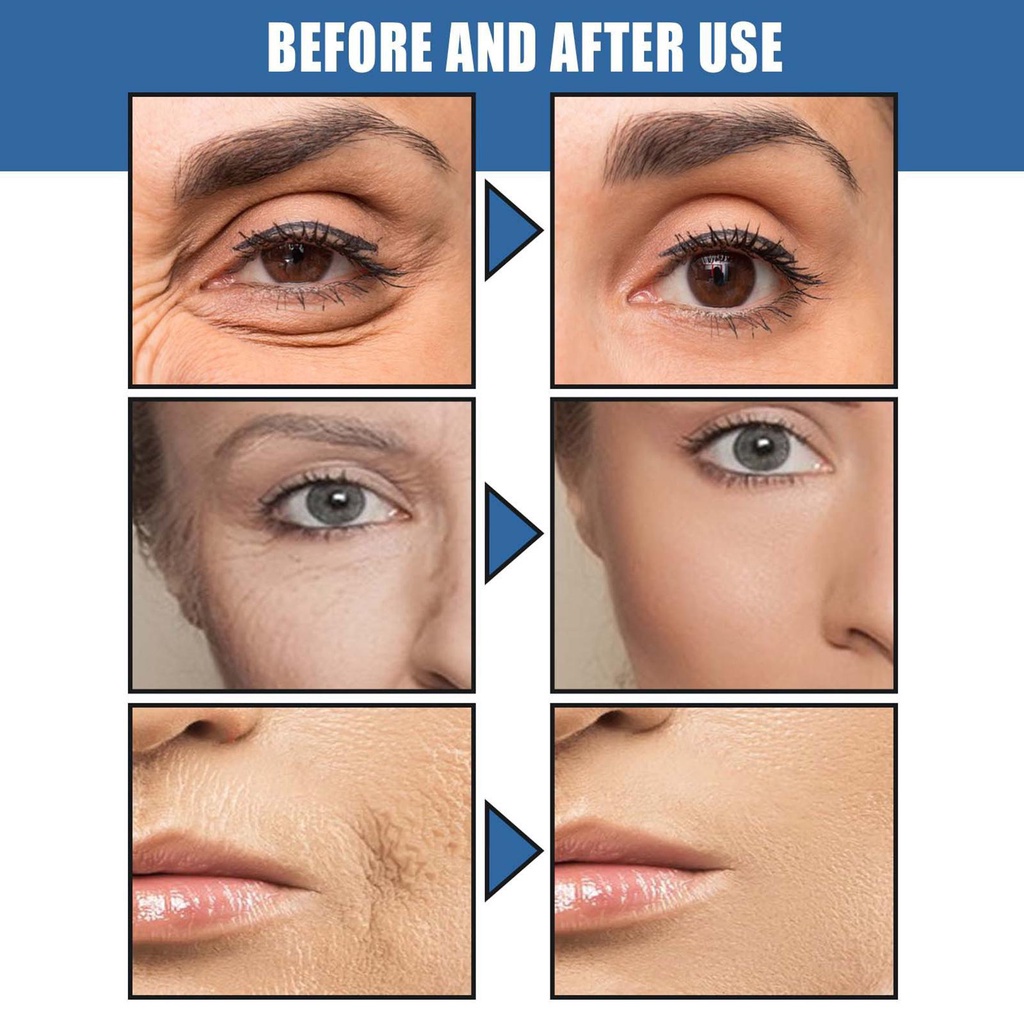 Kem Dưỡng Da Chống Lão Hóa 30g Retinol K2L5 Làm Săn Chắc Da Chống Nếp Nhăn Tức Thì