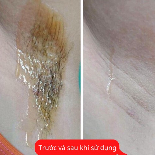 Wax lông An Lành 350g , tặng 50 tờ giấy và 2 que wax , sạch chân lông , không gây thâm da | BigBuy360 - bigbuy360.vn