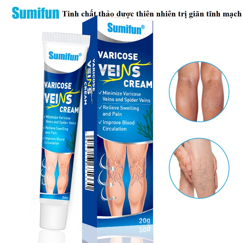 Kem chống suy giãn tĩnh mạch, tinh chất thảo dược thiên nhiên, giảm đau, giảm phình, ngăn ngừa các biến chứng