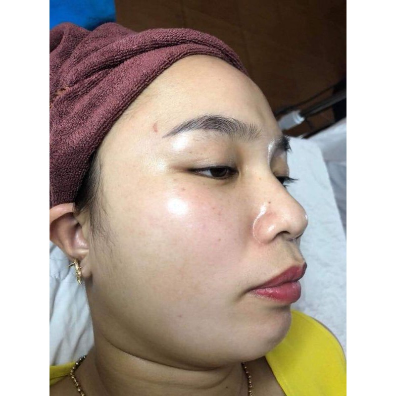 Bột Đánh Nám Tàn Nhang (gồm 2 bột và 1 lọ collagen đặc) | BigBuy360 - bigbuy360.vn