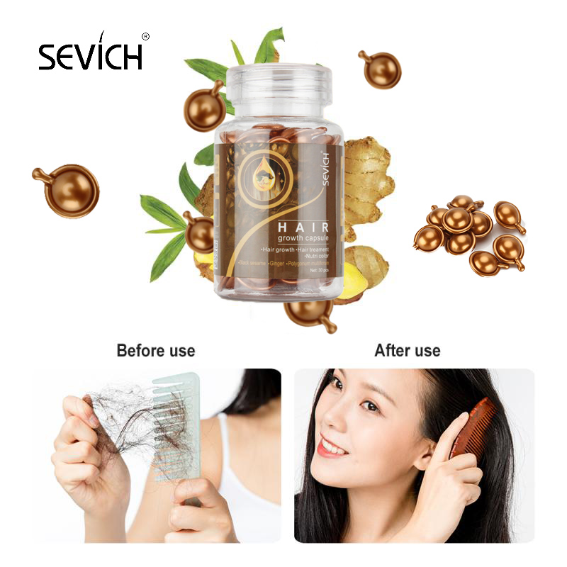 Hộp 30 viên nang SEVICH chứa huyết thanh vitamin dinh dưỡng tăng trưởng chống rụng tóc