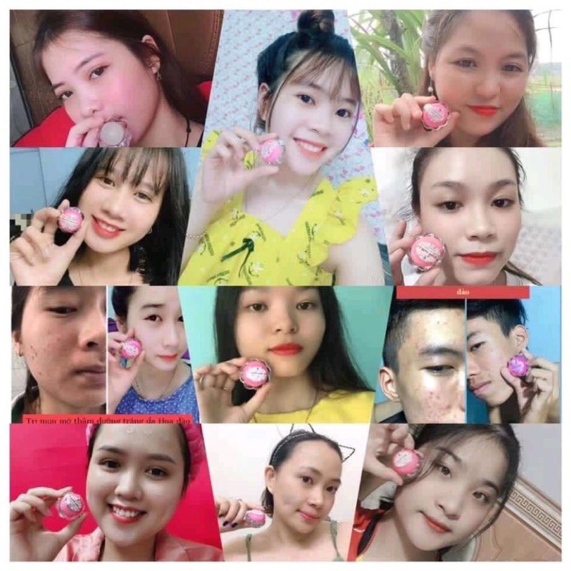 Kem Mụn Đông Y Hoa Đào Sạch Mụn, Trắng Da, Mờ Nám, Chấm Mụn Zini Store | BigBuy360 - bigbuy360.vn