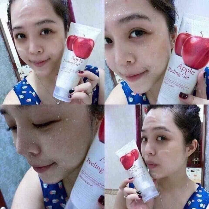 Kem tẩy da chếto