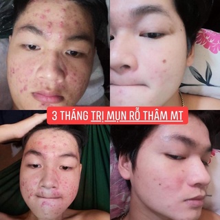 Tái Tạo Da MT (50ml)
