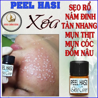 Chấm Đầy SẸO RỖ Lâu Năm. Quét Nám Tàn Nhang Peel HA SI