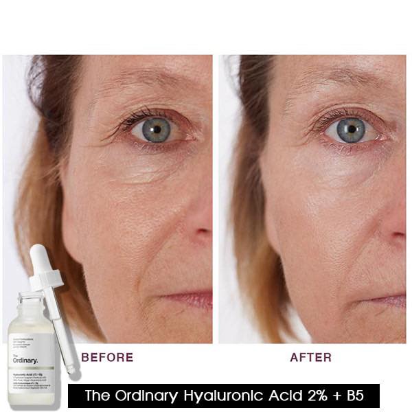 The Ordinary Hyaluronic Acid 2% + B5 30ml Tinh Chất Phục Hồi Và Dưỡng ẩm Sâu