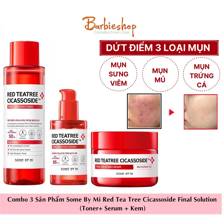 Combo 3 Sản Phẩm Giảm Mụn Cho Da Nhạy Cảm Some By Mi Red Tea Tree Cicassoside Final Solution (Toner+ Serum + Kem)