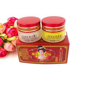 Bộ kem nám cô tiên đỏ Lulanjina ngày đêm - BX3159