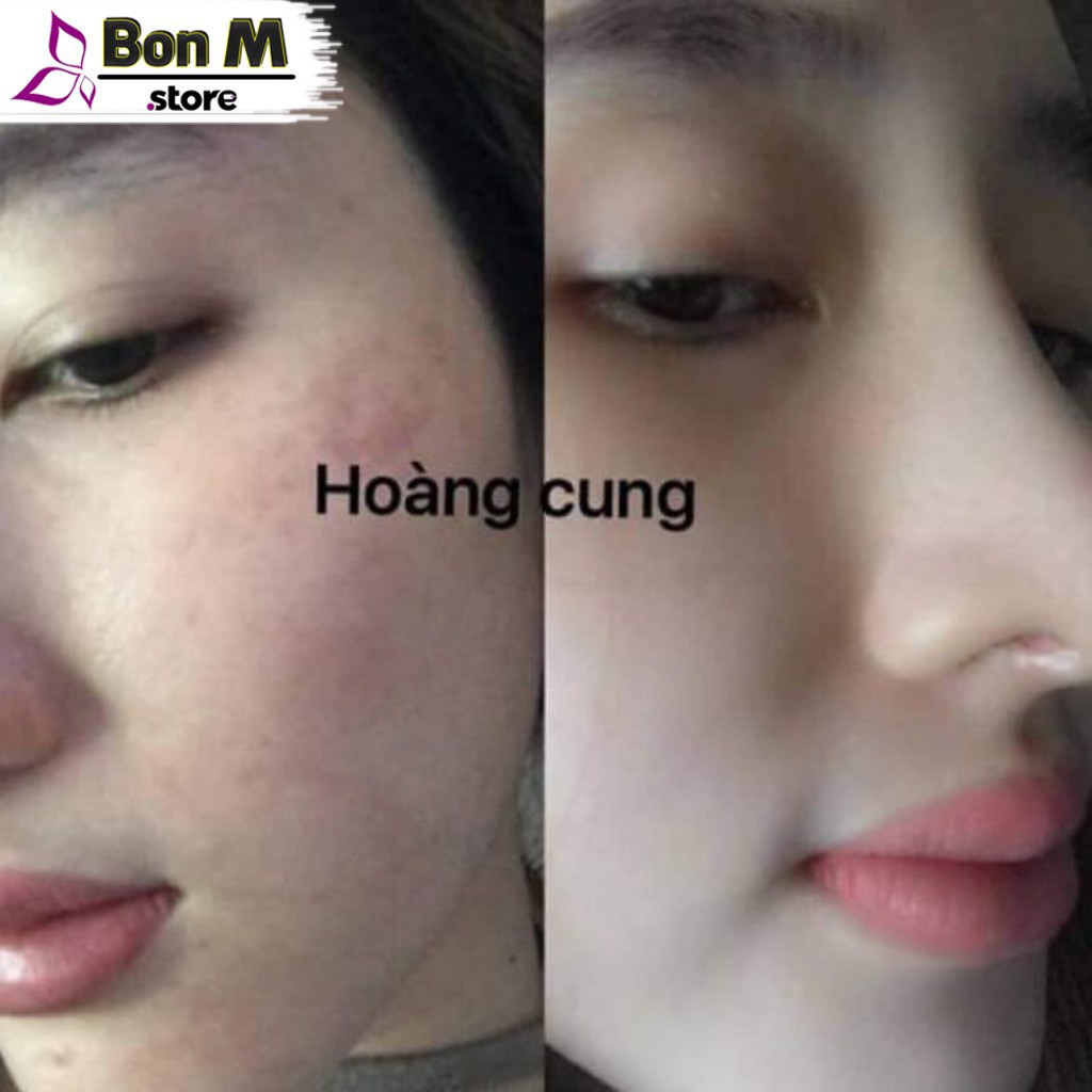 Bộ đôi hoàng cung Hồng (chuẩn 100%) | BigBuy360 - bigbuy360.vn