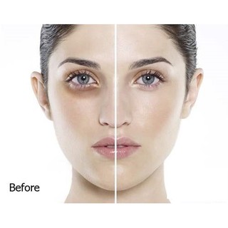 Lăn mắt Eveline Biohyaluron 4D Hàng Nga
