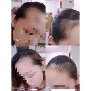 TINH CHẤT MỌC TÓC SATO NHẬT BẢN