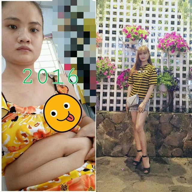 Thảo dược giảm cân gia truyền Cenly dành cho mẹ sữa | BigBuy360 - bigbuy360.vn