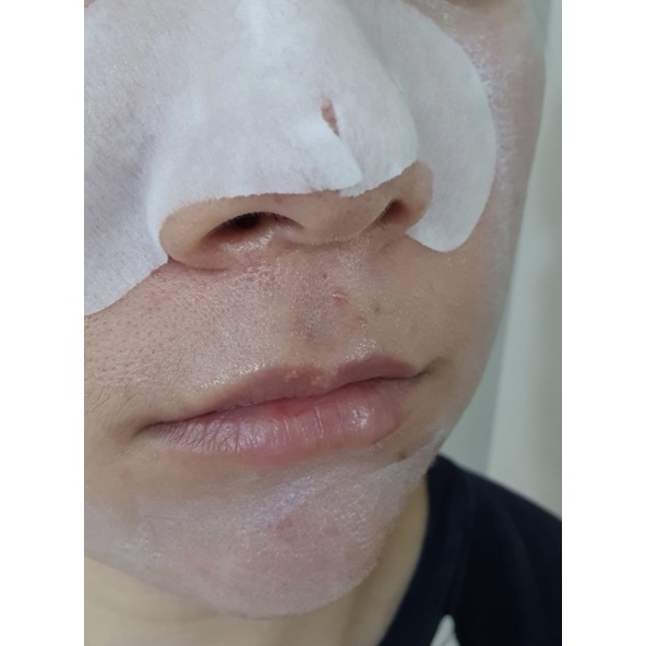Lột mụn đầu đen CNP Anti-Pore Black head clear kit - 10 miếng  Made in Korea