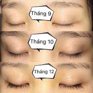 TInh chất dưỡng dài mi Gemsho
