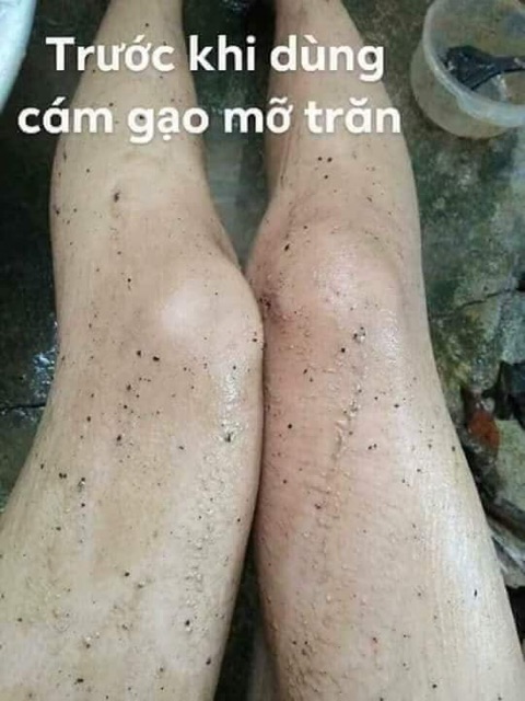 Combo Cám Gạo Cà Phê_Mỡ Trăn N'store