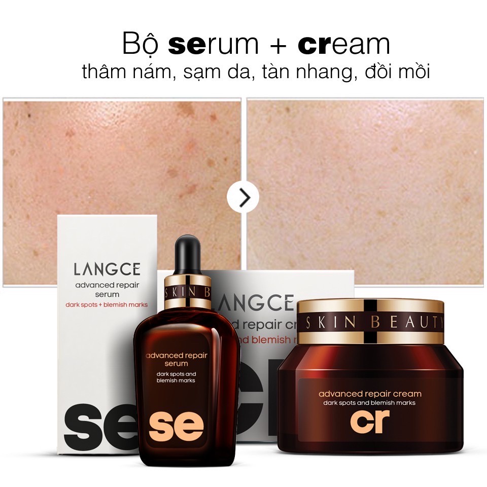 BỘ SErum+CReam THÂM NÁM, TÀN NHANG, ĐỒI MỒI, SẠM DA LANGCE
