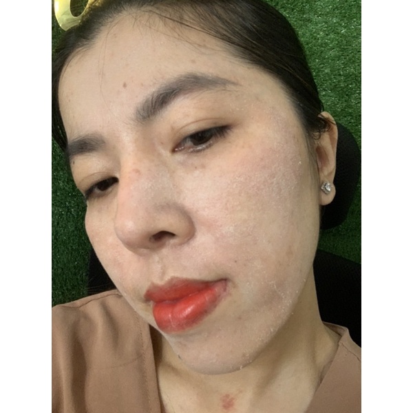 Kem Tái Tạo Da   My My T&M 20 gam tặng kích bong