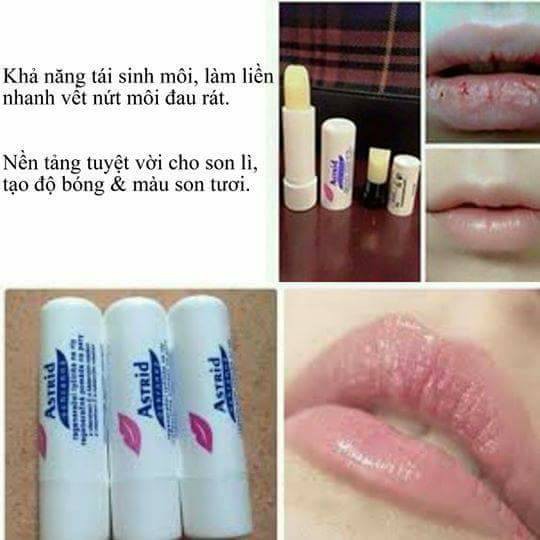 Son mỡ hươu - Astrid