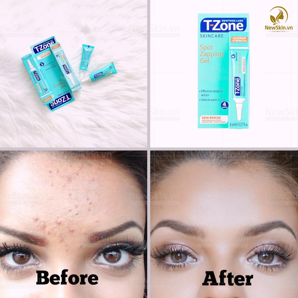 Gel chấm Mụn siêu tốc T Zone Skincare Spot Zapping Gel 8ml