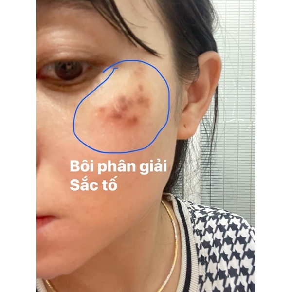 Tinh chất phân giải sắc tố B1, tái tạo da loại 1 - Handmade