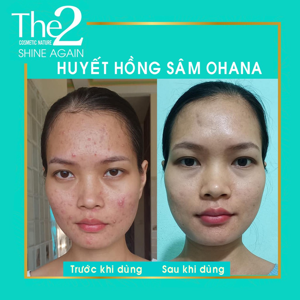 [Chính Hãng] HUYẾT HỒNG SÂM - Đông Y Vũ Đức | BigBuy360 - bigbuy360.vn