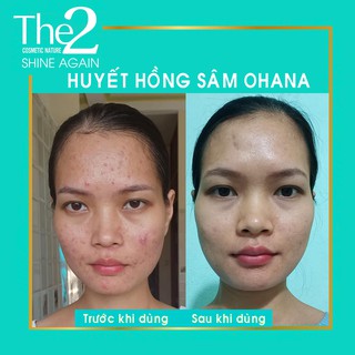 [Chính Hãng] HUYẾT HỒNG SÂM - Đông Y Vũ Đức