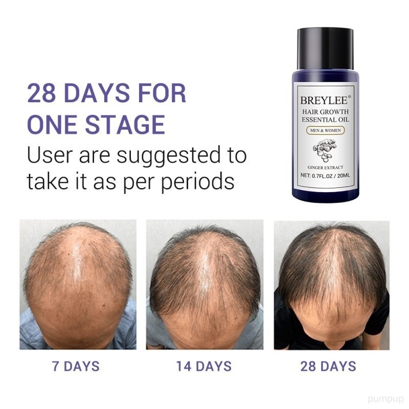 Tinh Dầu Kích Thích Mọc Tóc Chống Khô Và Rụng Tóc 20ml