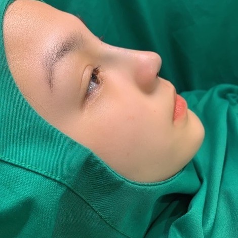 Săng Phẫu thuật thẩm mỹ viện, spa - Săng mổ bệnh viện xanh lá size 50x50 | BigBuy360 - bigbuy360.vn