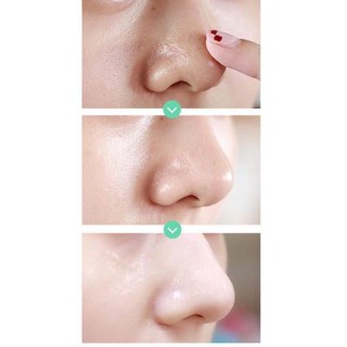 Serum tinh chất se khít lỗ chân lông hiệu quả