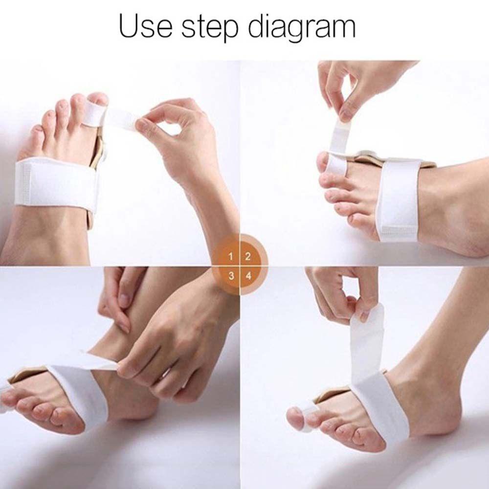 Máy Duỗi Chỉnh Hình Ngón Chân Cái Chuyên Nghiệp Bền Bỉ