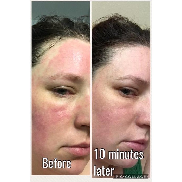 REN Evercalm Ultra Comforting Rescue Mask - Mặt nạ cấp ẩm làm dịu da kích ứng