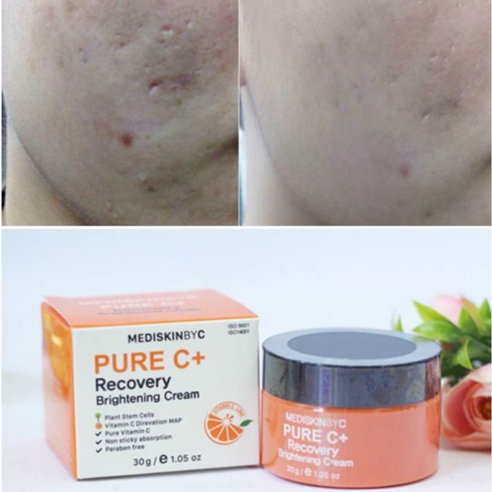 Kem dưỡng MediskinbyC Pure C+ Recovery Brightening Cream 50g