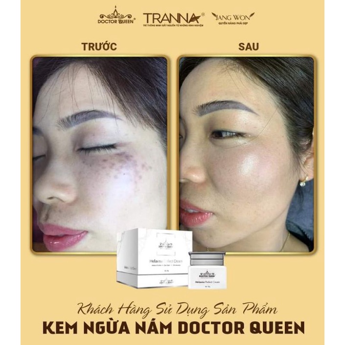 NÁM DOCTOR QUEEN Jangwon kem ức chế nám  cho spa