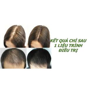 ⚡HÀNG CHÍNH HÃNG⚡ Bộ dầu gội trị rụng tóc, bạc tóc Thu Hương | BigBuy360 - bigbuy360.vn