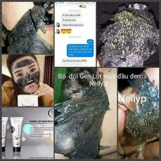 Bộ đôi lột mụn Nellyp ( linh gửi)
