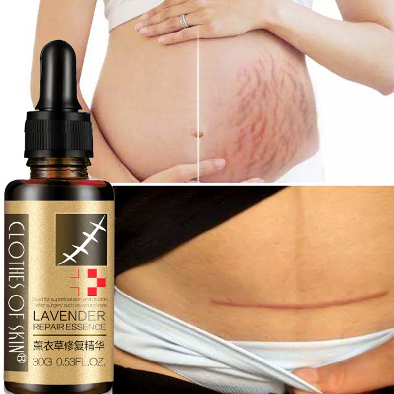 Tinh chất làm mờ vết sẹo phục hồi làn da hiệu quả
