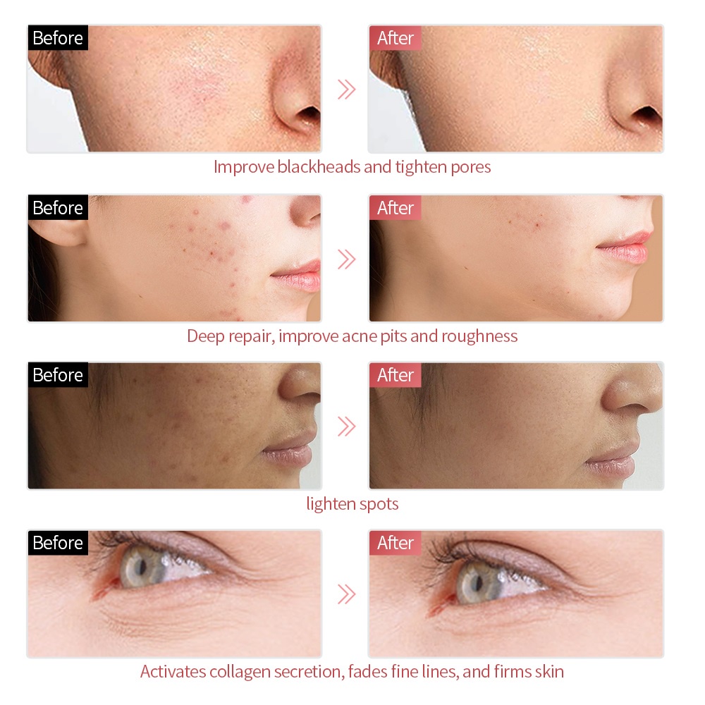 Mặt nạ chăm sóc da FOREVERLILY có đèn LED 7 màu sắc loại bỏ nếp nhăn kèm phụ kiện