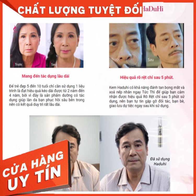 Haduhi Kem Xoá Nhăn Làm Tan Bọng Mắt 15 Gam [ Hàng nhập khẩu Hàn Quốc - Freeship ] | BigBuy360 - bigbuy360.vn