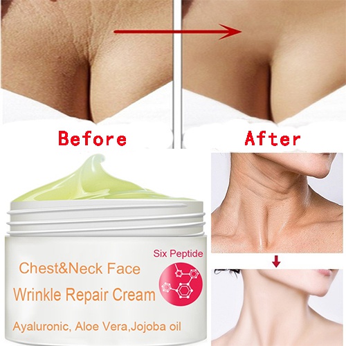 [Hàng mới về] Kem dưỡng da mặt và cổ ngăn ngừa nếp nhăn săn chắc da
