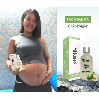 Tinh dầu trị rạn da BAE 50ml