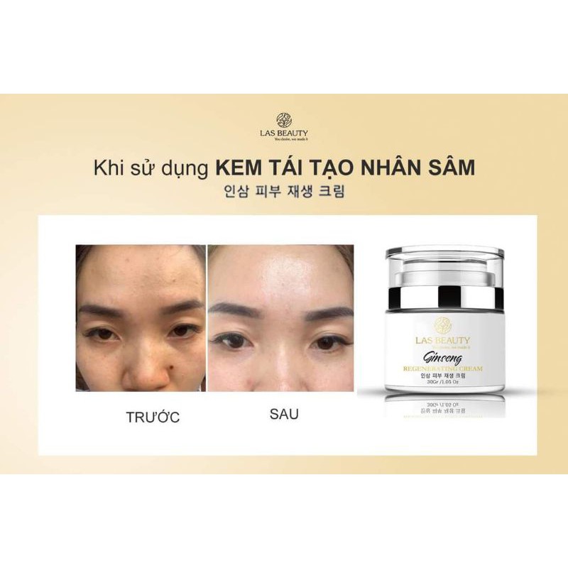 KEM TÁI TẠO DA NHÂN SÂM LAS BEAUTY TỪ HÀN QUỐC | BigBuy360 - bigbuy360.vn