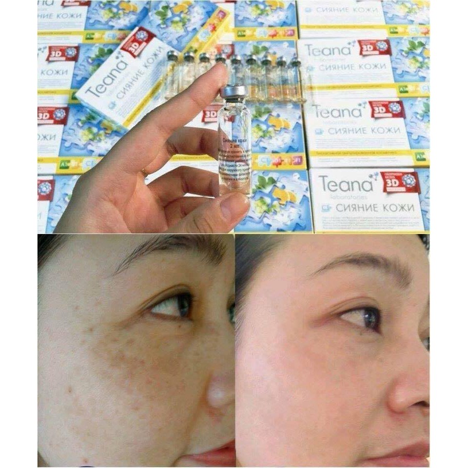 Bộ 10 ống tinh chất Collagen tươi Teana 3D- Nga