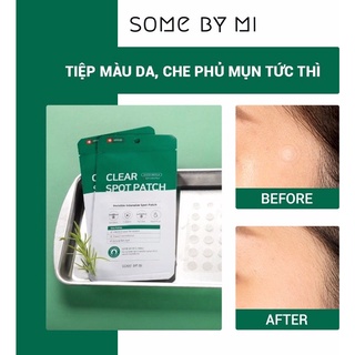 Miếng dán mụn Some By Mi Don't Pop It. Just Leave It 18 miếng