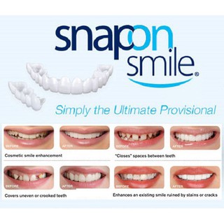  Răng giả Snap on smile loại tốt  O((Ảnh chính chủ))