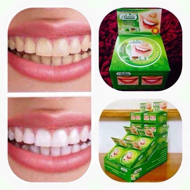 Kem trắng răng Green Herb 25g Thái Lan