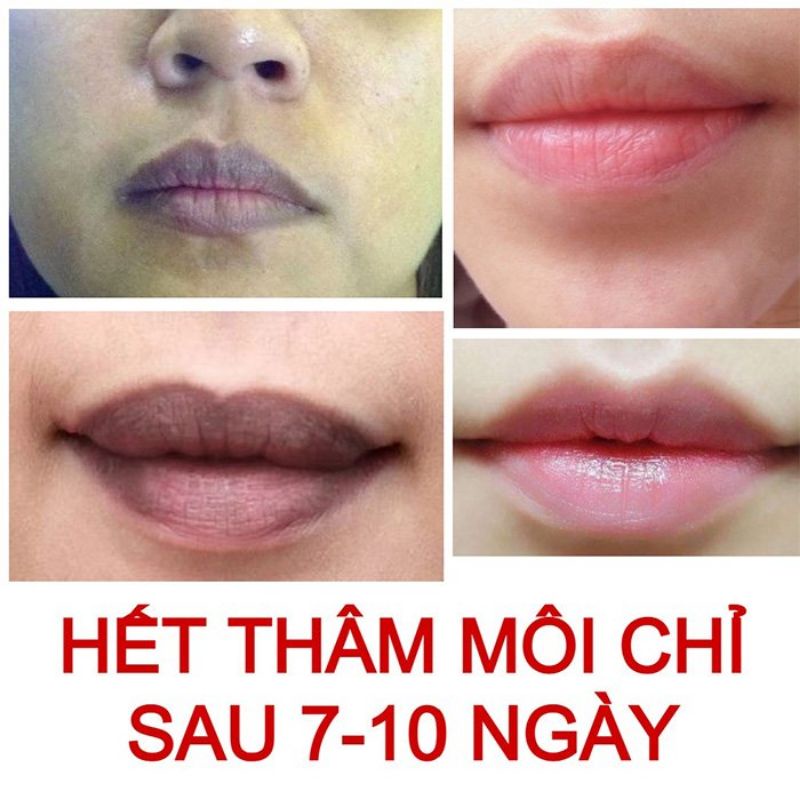 Tẩy thâm môi collagen Thiên Di khử thâm môi dưỡng hồng môi giúp môi mềm mịn an toàn 100%