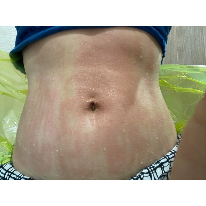 Bộ ủ nóng tan mỡ Slimming body | BigBuy360 - bigbuy360.vn