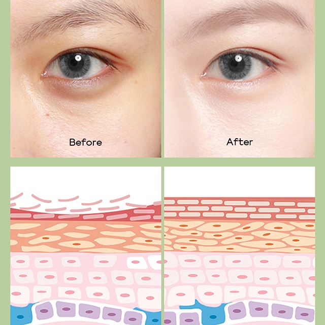 Kem Dưỡng Da Mắt Giúp Giảm Bọng Mắt Fenyi EYE CREAM Green Tea Chiết Xuất Từ Trà Xanh  15g