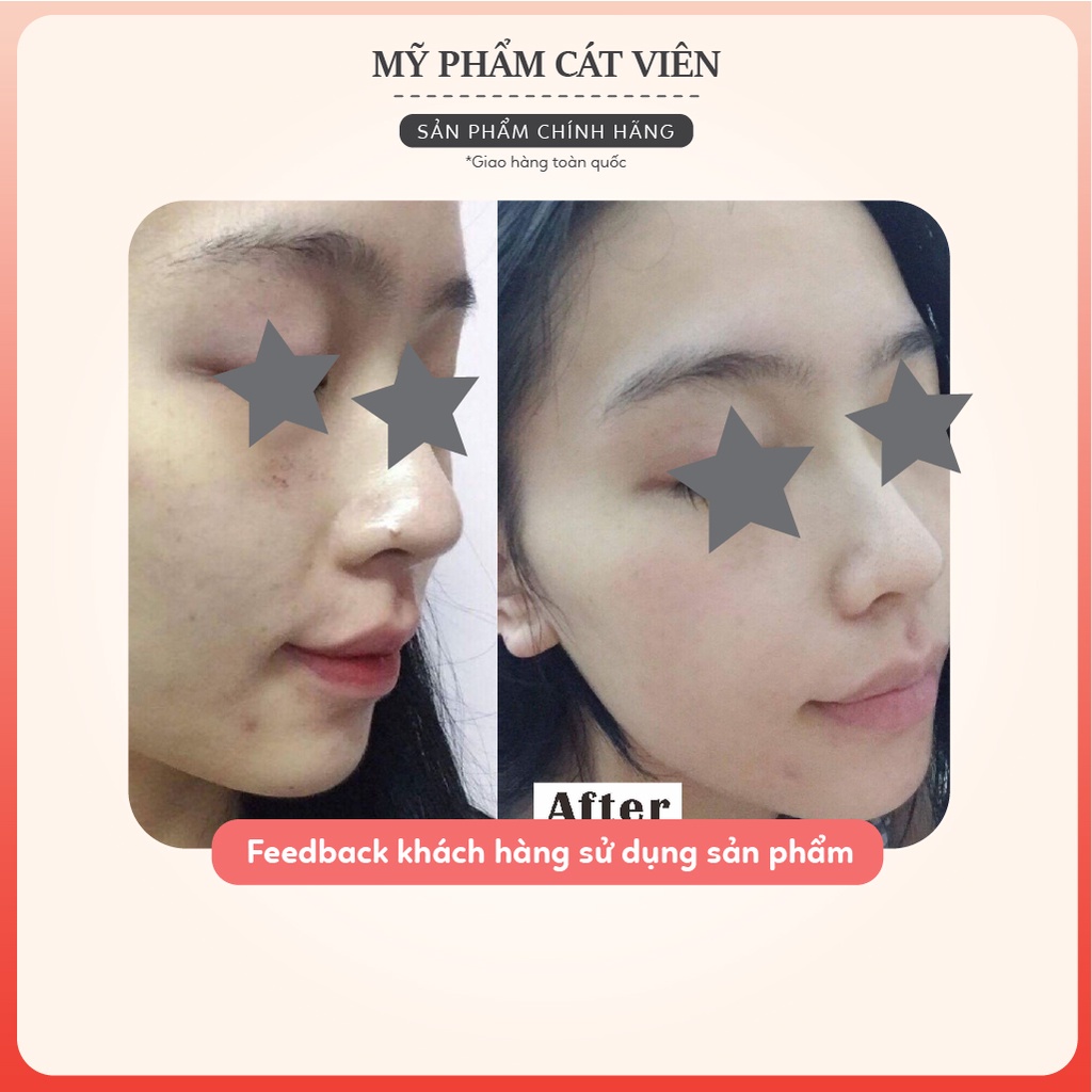 Kem dưỡng ẩm Hyalogy Moisture Mela Gel Rien'A - căng bóng, chăm sóc da hư tổn, cải thiện lão hóa - Hũ 50g